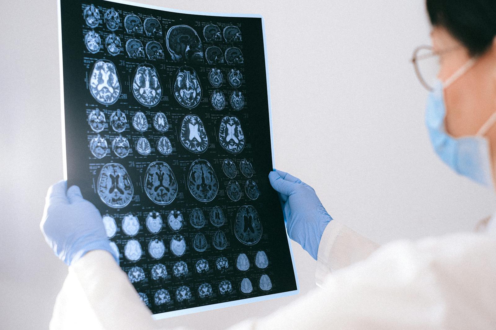 brain chemistry research