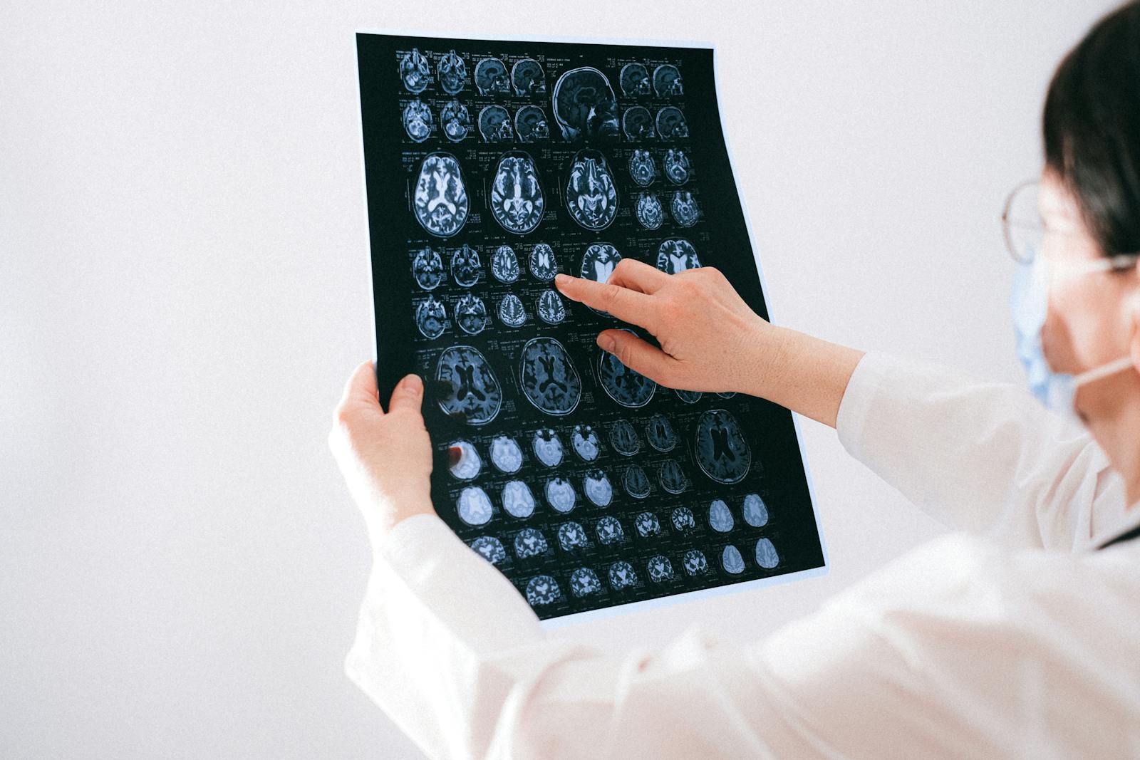 dmnews.com - Rachel Summers - Scientists say ADHD has two structurally distinct brain subtypes and treating them as one condition may explain why so many treatments fail