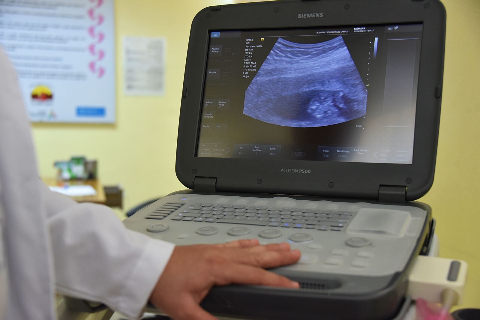 ultrasound machine clinic